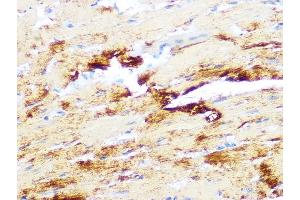 Immunohistochemistry of paraffin-embedded mouse heart using Myosin heavy chain Rabbit mAb (ABIN7268750) at dilution of 1:100 (40x lens). (MYH7 antibody)