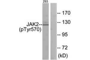 Western blot analysis of extracts from 293 cells treated with etoposide 25uM 24h, using JAK2 (Phospho-Tyr570) Antibody.