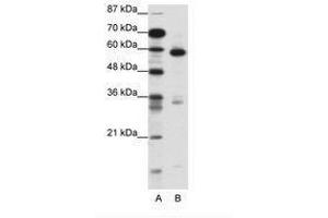 Image no. 1 for anti-Methyl-CpG Binding Domain Protein 1 (MBD1) (C-Term) antibody (ABIN202746) (MBD1 antibody  (C-Term))