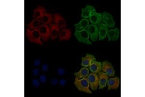 ABIN6257434 and ABIN6273695 staining Hela cells by IF/ICC. (PLCE1 antibody  (C-Term))