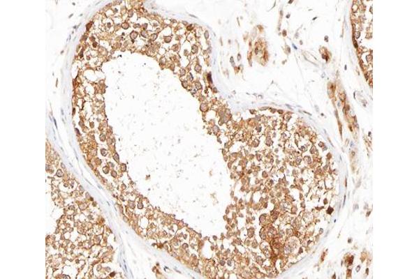 MMP16 antibody  (C-Term)