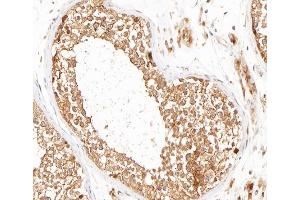 ABIN6266593 at 1/100 staining human testis tissue sections by IHC-P. (MMP16 antibody  (C-Term))