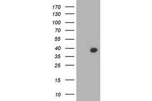 Western Blotting (WB) image for anti-HSPA Binding Protein, Cytoplasmic Cochaperone 1 (HSPBP1) antibody (ABIN1498758) (HSPBP1 antibody)