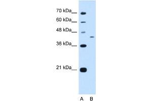 WB Suggested Anti-KIAA0515 Antibody Titration:  0.