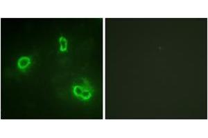 Immunofluorescence analysis of COS7 cells, using p90 RSK (Ab-573) Antibody. (RPS6KA3 antibody  (AA 539-588))