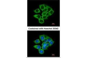 ICC/IF Image Immunofluorescence analysis of methanol-fixed A431, using EEF1D, antibody at 1:200 dilution. (EEF1D antibody)