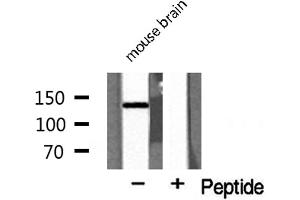 MAP4K4 antibody  (Internal Region)