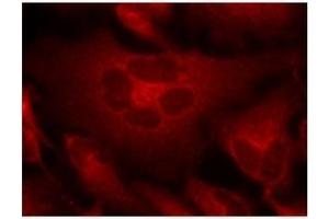 Image no. 1 for anti-Breakpoint Cluster Region (BCR) (Tyr177) antibody (ABIN197421) (BCR antibody  (Tyr177))