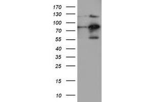 HEK293T cells were transfected with the pCMV6-ENTRY control (Left lane) or pCMV6-ENTRY FOLH1 (Right lane) cDNA for 48 hrs and lysed. (PSMA antibody)