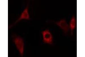 ABIN6278432 staining Hela cells by IF/ICC. (Cathepsin H antibody  (Internal Region))