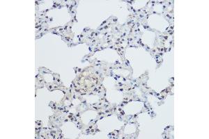 Immunohistochemistry (IHC) image for anti-X-Ray Repair Complementing Defective Repair in Chinese Hamster Cells 1 (XRCC1) (AA 1-320) antibody (ABIN1683300)