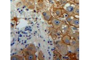 Used in DAB staining on fromalin fixed paraffin-embedded Liver tissue (Interferon gamma antibody  (AA 24-166))