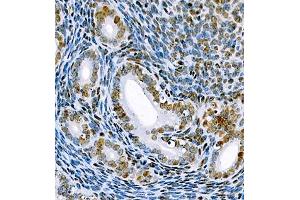 Immunohistochemistry of paraffin embedded mouse uterus using SRRM2 (ABIN7075555) at dilution of 1:650 (400x lens) (SRRM2 antibody)