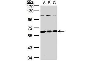 WB Image Sample(30 ug whole cell lysate) A:H1299 B:HeLa S3, C:Hep G2 , 7.