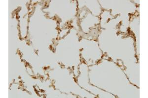 Immunoperoxidase of monoclonal antibody to SH2D4A on formalin-fixed paraffin-embedded human lung. (SH2D4A antibody  (AA 239-338))