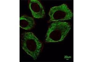 Immunofluorescent analysis of A549 cells using beta-Tubulin antibody at 1:25 dilution. (TUBB1 antibody)