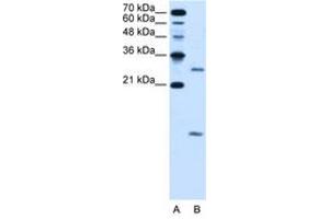 Image no. 2 for anti-Vacuolar H+-ATPase Homolog (VMA21) (N-Term) antibody (ABIN205060) (VMA21 antibody  (N-Term))