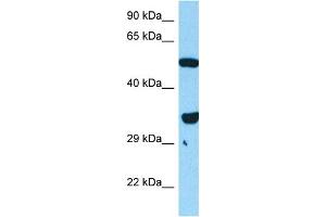 Host:  Mouse  Target Name:  FOXL1  Sample Tissue:  Mouse Skeletal Muscle  Antibody Dilution:  1ug/ml (FOXL1 antibody  (N-Term))