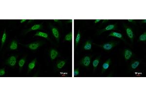 ICC/IF Image hnRNP R antibody [N1N2], N-term detects hnRNP R protein at nucleus and cytoplasm by immunofluorescent analysis. (HNRNPR antibody  (N-Term))