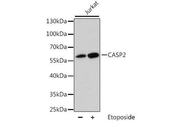 Caspase 2 antibody  (AA 153-452)