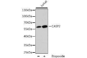 Western blot analysis of extracts of Jurkat cells, using CASP2 antibody. (Caspase 2 antibody  (AA 153-452))
