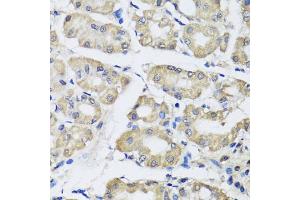 Immunohistochemistry of paraffin-embedded human stomach using SCG3 antibody (ABIN5975187) at dilution of 1/100 (40x lens). (SCG3 antibody)