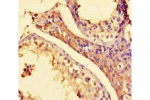 Immunohistochemistry of paraffin-embedded human testis tissue using ABIN7155509 at dilution of 1:100 (SETD1A antibody  (AA 188-304))