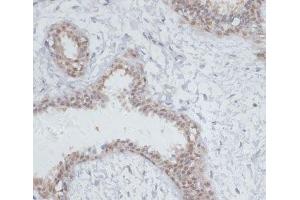 Immunohistochemistry of paraffin-embedded Human breast using NOL3 Polyclonal Antibody at dilution of 1:100 (40x lens). (NOL3 antibody)