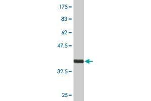 Western Blot detection against Immunogen (36. (KRTAP13-1/KAP13.1 antibody  (AA 2-100))