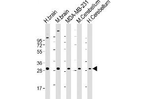 Western Blotting (WB) image for anti-RAB23, Member RAS Oncogene Family (RAB23) antibody (ABIN1539872)