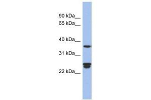 OAZ2 antibody used at 1 ug/ml to detect target protein. (OAZ2 antibody  (Middle Region))