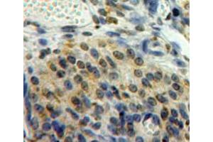 Used in DAB staining on fromalin fixed paraffin-embedded ovary tissue (EGR2 antibody  (AA 147-403))