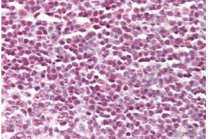 Anti-STAT5A antibody IHC staining of human tonsil. (STAT5A antibody  (AA 745-794))
