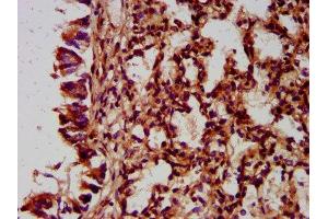 IHC image of ABIN7165873 diluted at 1:400 and staining in paraffin-embedded human lung tissue performed on a Leica BondTM system.