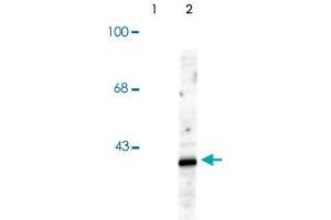 Western blot of HeLa cell lysates that had been treated with UV or untreated (Control) showing specific immunolabeling of the ~39k p38 Mapk14 protein phosphorylated at Thr180 and Tyr182. (MAPK14 antibody  (pThr180, pTyr182))