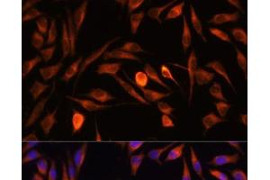 Immunofluorescence analysis of L929 cells using PTCD1 Polyclonal Antibody at dilution of 1:100. (PTCD1 antibody)