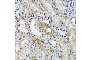 Immunohistochemistry (IHC) image for anti-Eukaryotic Translation Initiation Factor 2B, Subunit 5 Epsilon, 82kDa (EIF2B5) antibody (ABIN7267038)