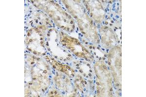 Immunohistochemistry of paraffin-embedded mouse kidney using eIF2B epsilon (EIF2B5) (EIF2B5) Rabbit mAb (ABIN7267038) at dilution of 1:100 (40x lens). (EIF2B5 antibody)