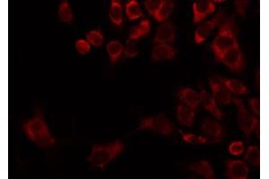 ABIN6274736 staining HepG2 by IF/ICC. (MRPL22 antibody  (Internal Region))