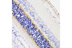 Immunohistochemistry of paraffin-embedded rat retina using  antibody (ABIN6129704, ABIN6136903, ABIN6136905 and ABIN6216979) at dilution of 1:200 (40x lens).