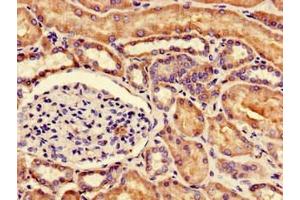 Immunohistochemistry of paraffin-embedded human kidney tissue using ABIN7147921 at dilution of 1:100 (NUDT21 antibody  (AA 2-227))