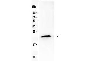 Western blot analysis of TMEM107 using anti- TMEM107 antibody . (TMEM107 antibody  (N-Term))