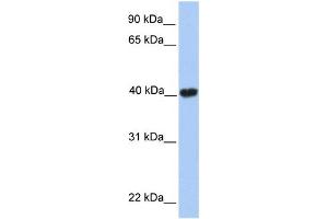WB Suggested Anti-MGC29891 Antibody Titration:  0.