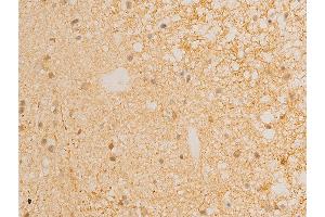 Immunohistochemistry (IHC) image for anti-Nuclear Factor of kappa Light Polypeptide Gene Enhancer in B-Cells Inhibitor, epsilon (NFKBIE) (pSer161) antibody (ABIN6255101)