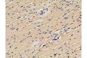 ABIN7096260 and ABIN7100322 at 1/100 staining mouse heart tissue by IHC-P.