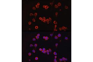 Immunofluorescence analysis of Jurkat cells using NF Rabbit pAb (ABIN3022100, ABIN3022101, ABIN3022102 and ABIN6218604) at dilution of 1:100 (40x lens). (NFATC1 antibody  (AA 20-300))