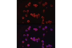Immunofluorescence analysis of Jurkat cells using NF Rabbit pAb (ABIN3022100, ABIN3022101, ABIN3022102 and ABIN6218604) at dilution of 1:100 (40x lens). (NFATC1 antibody  (AA 20-300))
