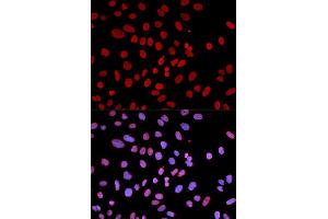Immunofluorescence analysis of U2OS cell using PTPN6 antibody. (SHP1 antibody)