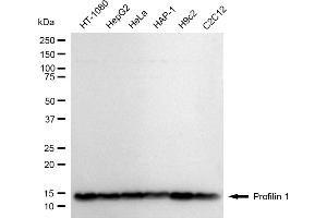 anti-Profilin 1 (PFN1) antibody