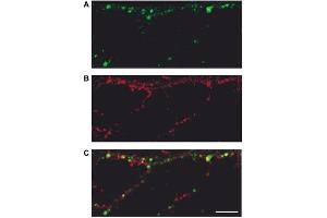 Fluorescence Microscopy (FM) image for Goat anti-Guinea Pig IgG (Heavy & Light Chain) antibody (Texas Red (TR)) - Preadsorbed (ABIN101285)